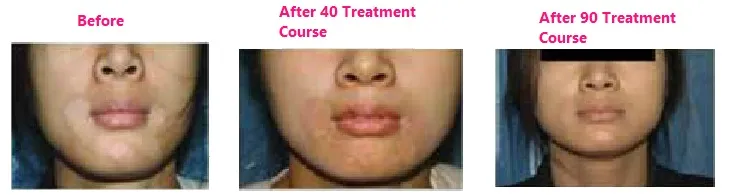 clinical-results