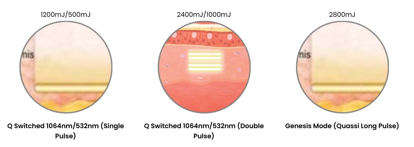 qswitch