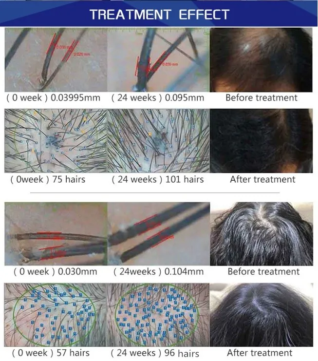 treatment-effects