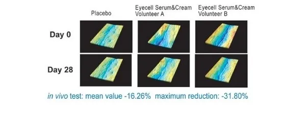 eye1
