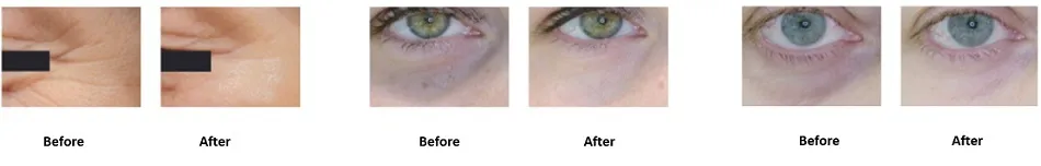 eyecell-clinical-results