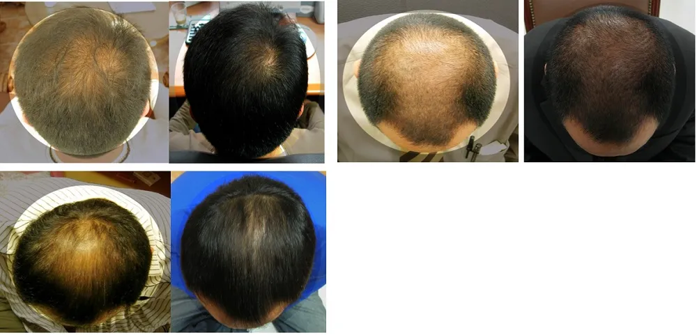 hr3-matrix-pre-post1
