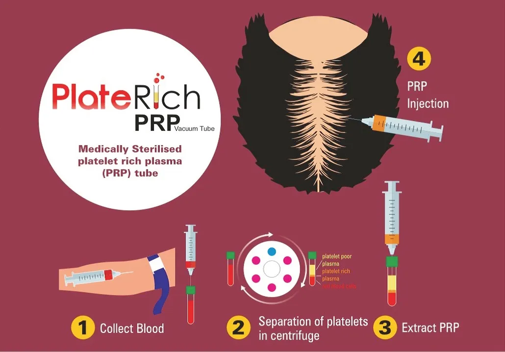 prp-tube